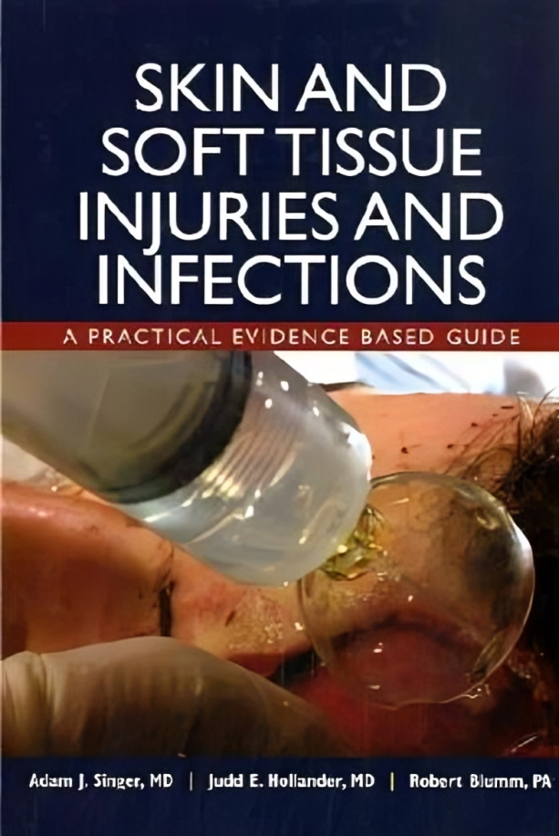 Skin and Soft Tissue Injuries & Infections