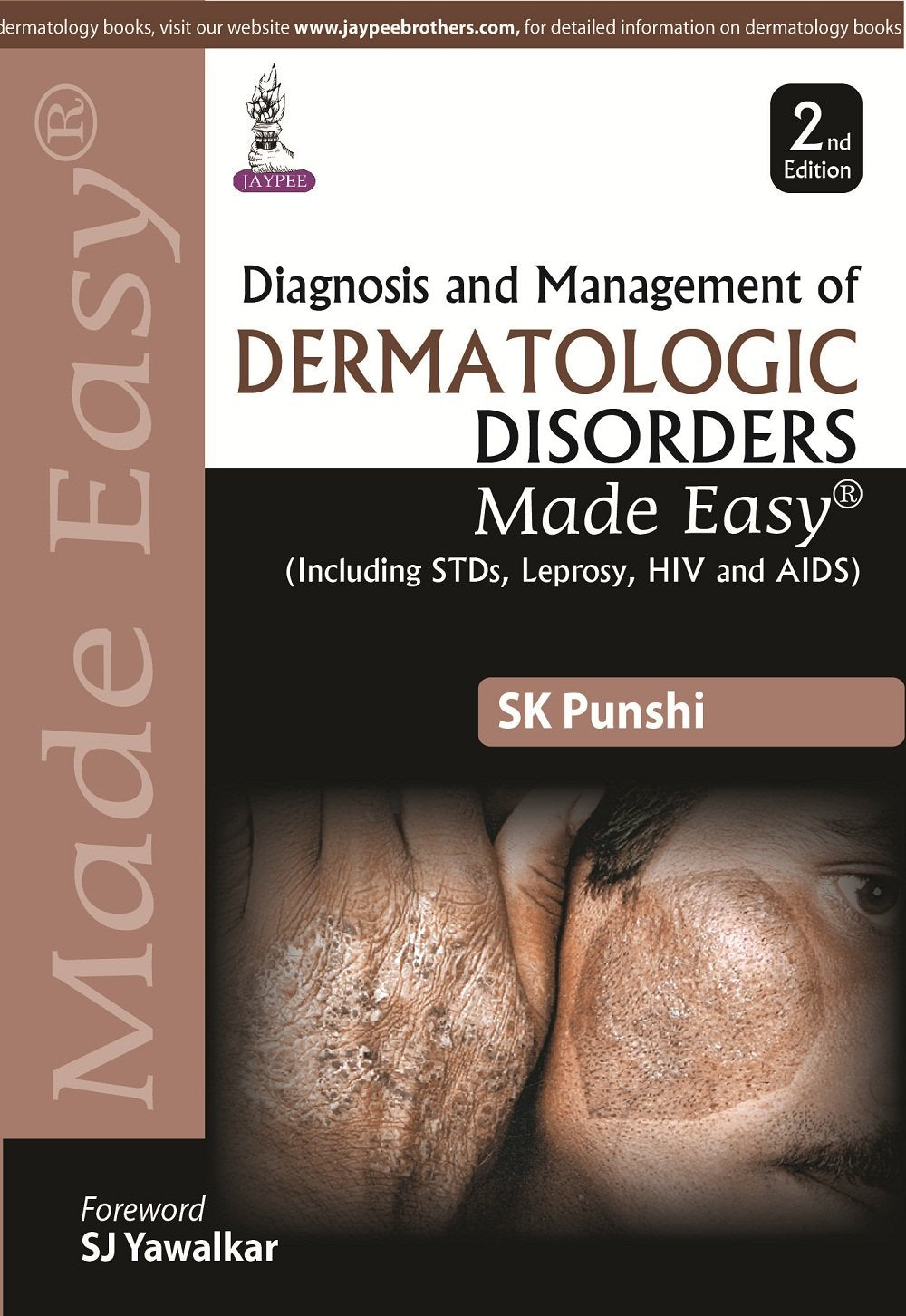 Diagnosis and Management of Dermatologic Disorders Made Easy, 2nd Edition
