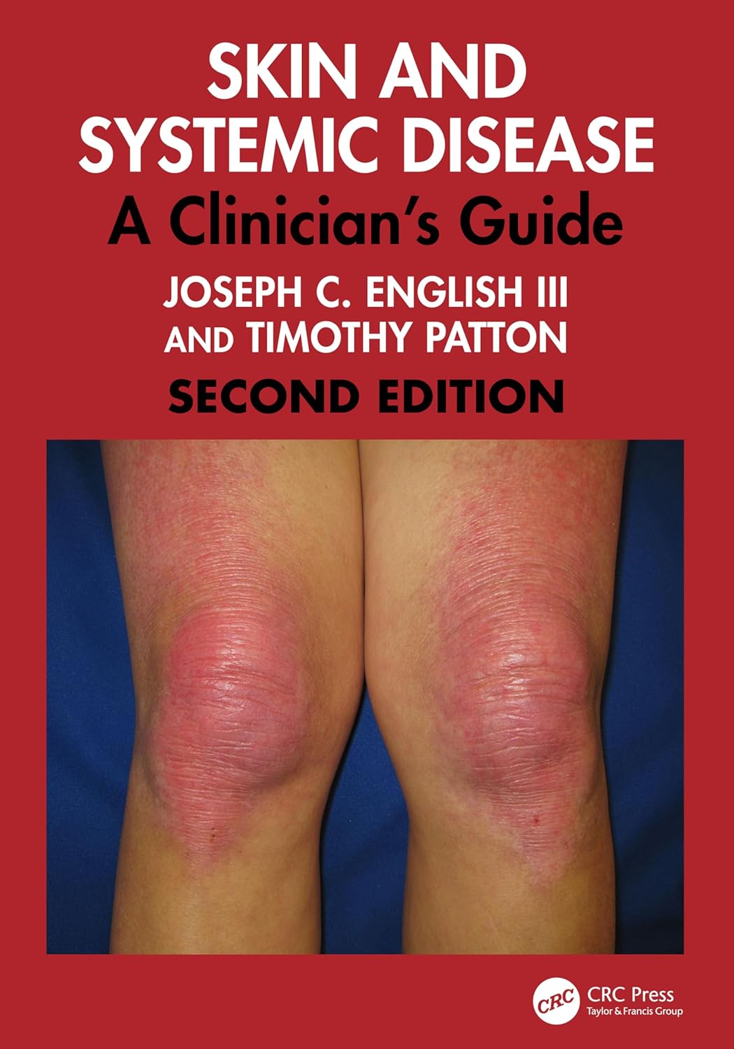 Skin and Systemic Disease: A Clinician’s Guide