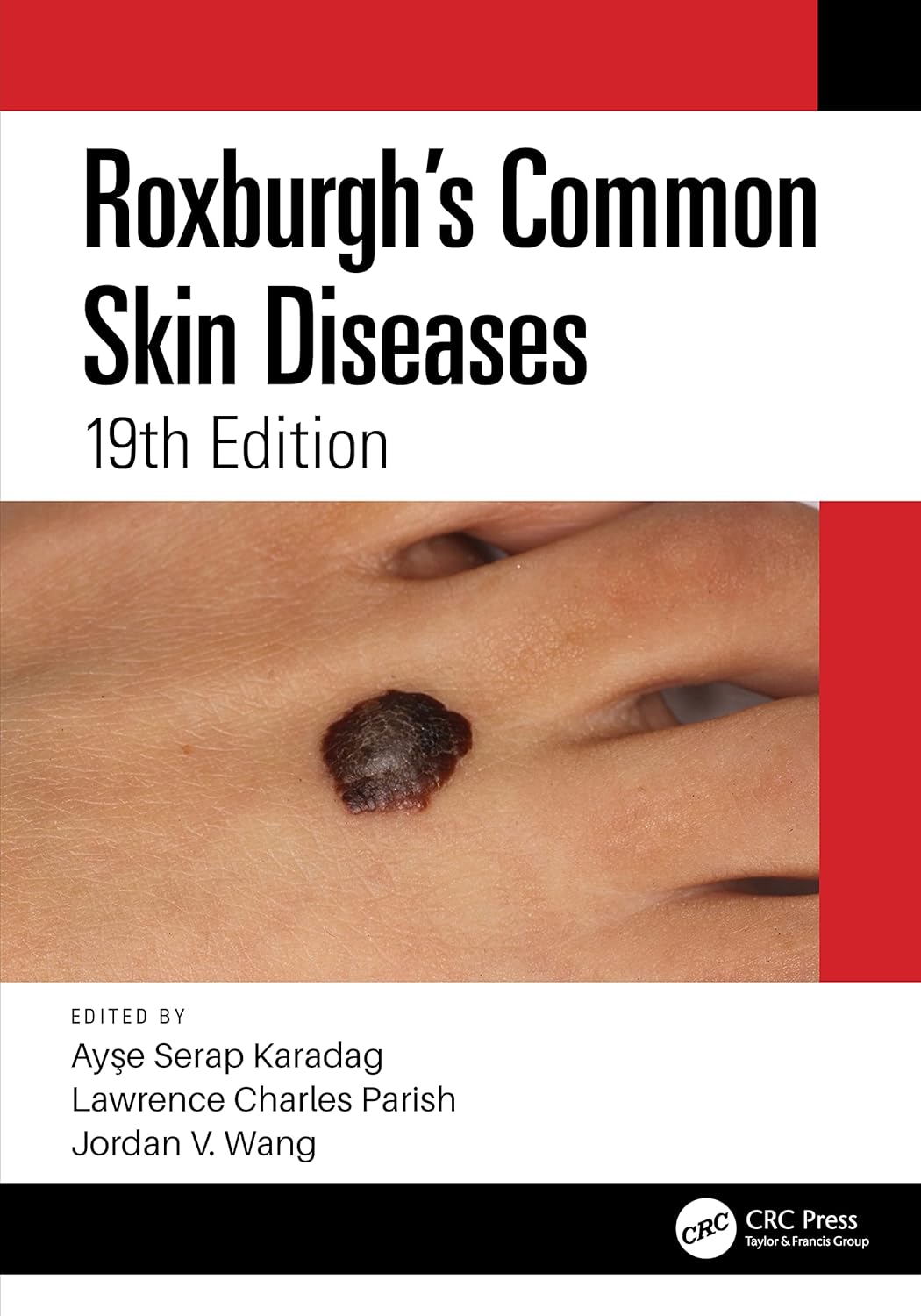 Roxburgh’s Common Skin Diseases, 19th Edition