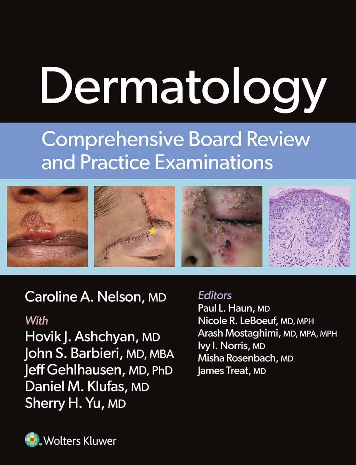 Dermatology: Comprehensive Board Review and Practice Examinations