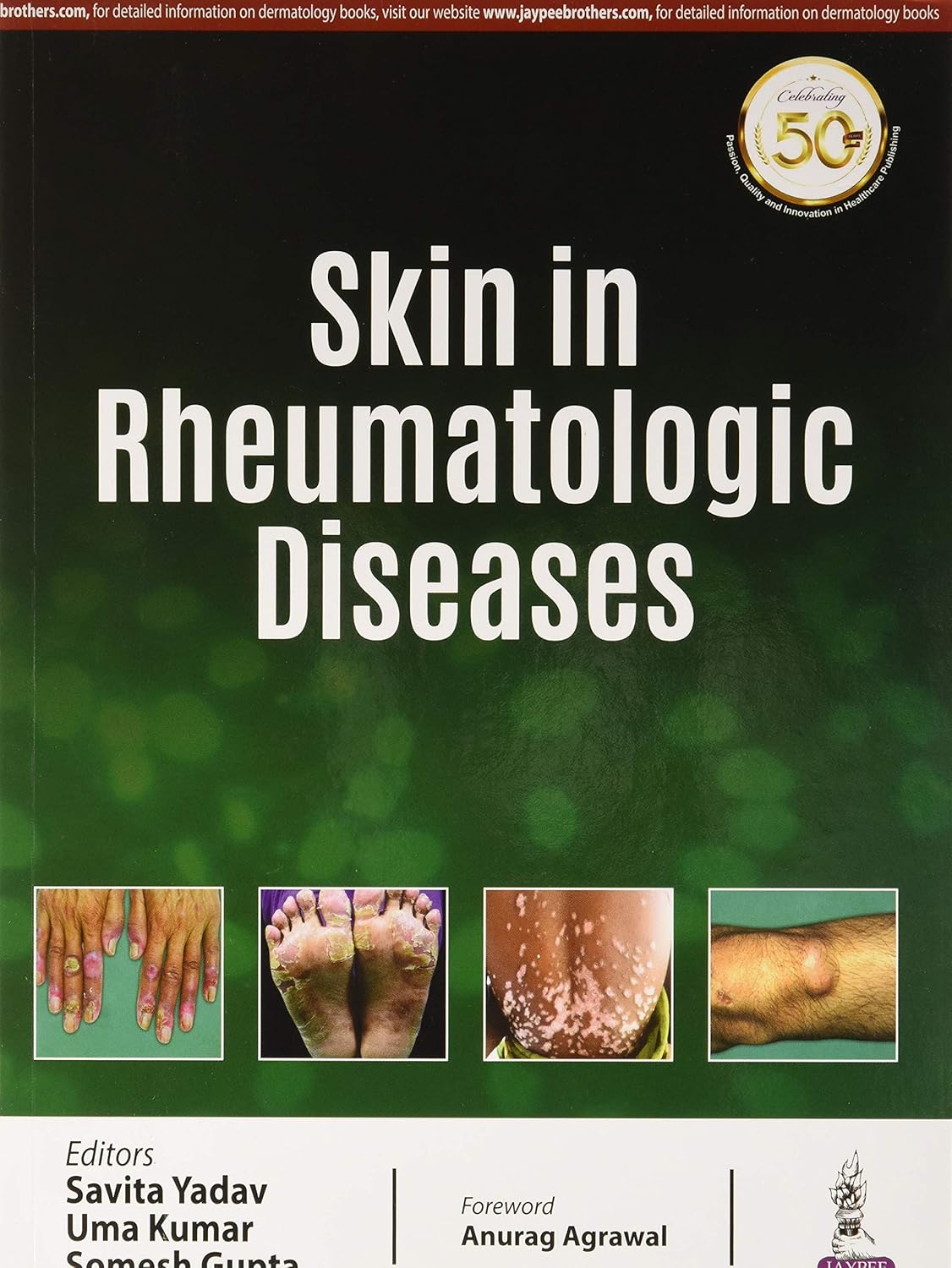 Skin In Rheumatologic Diseases