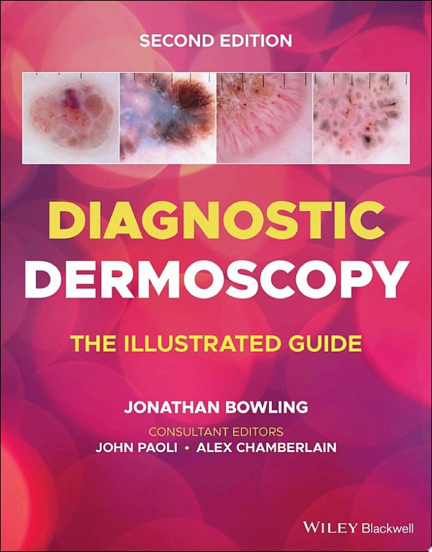 Diagnostic Dermoscopy: The Illustrated Guide, 2nd edition