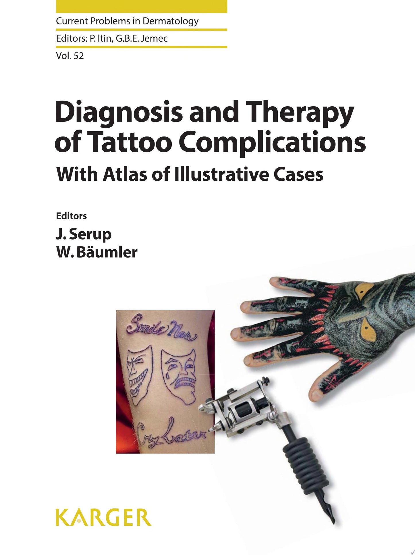 Diagnosis and Therapy of Tattoo Complications: With Atlas of Illustrative Cases