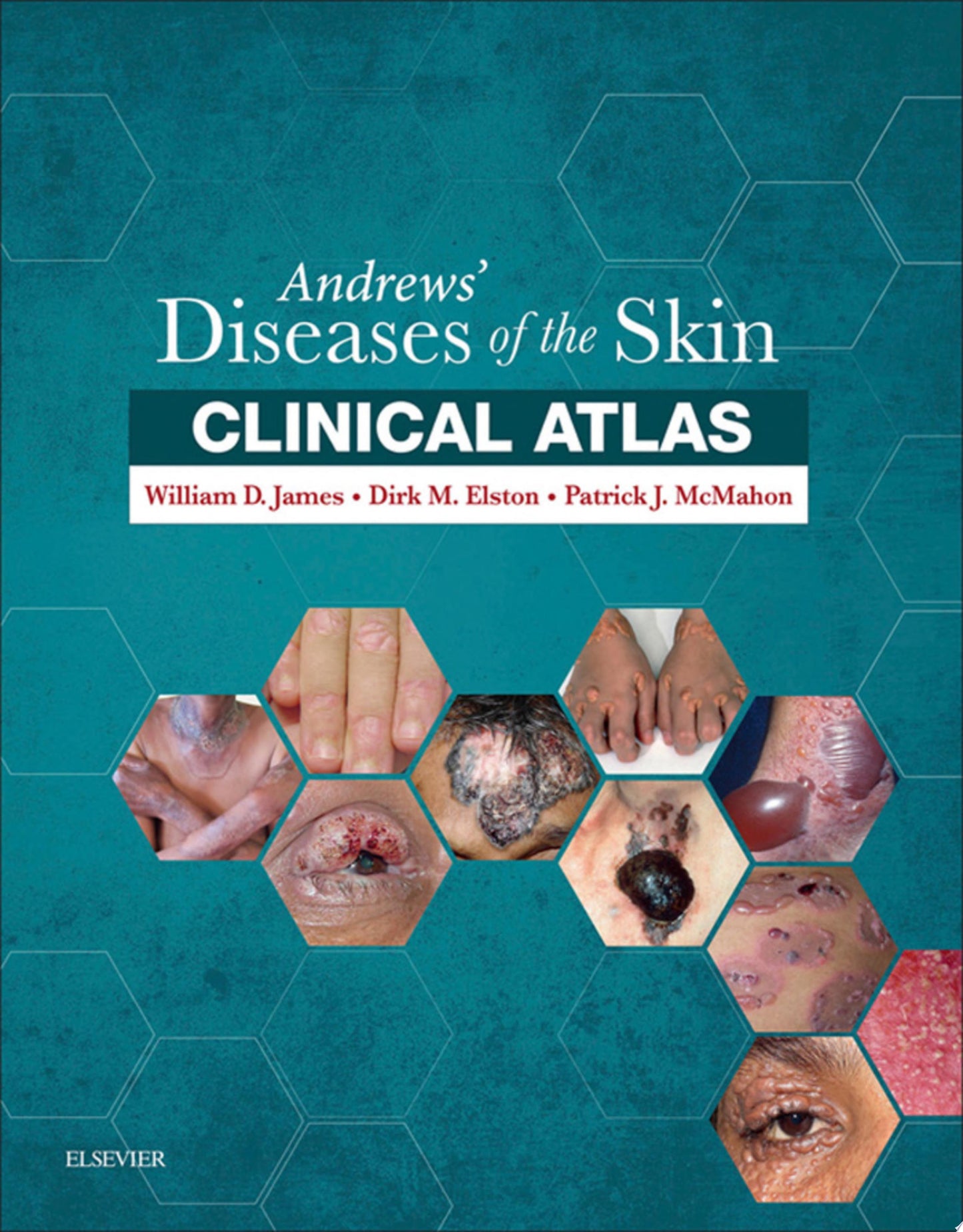 Andrews’ Diseases of the Skin Clinical Atlas