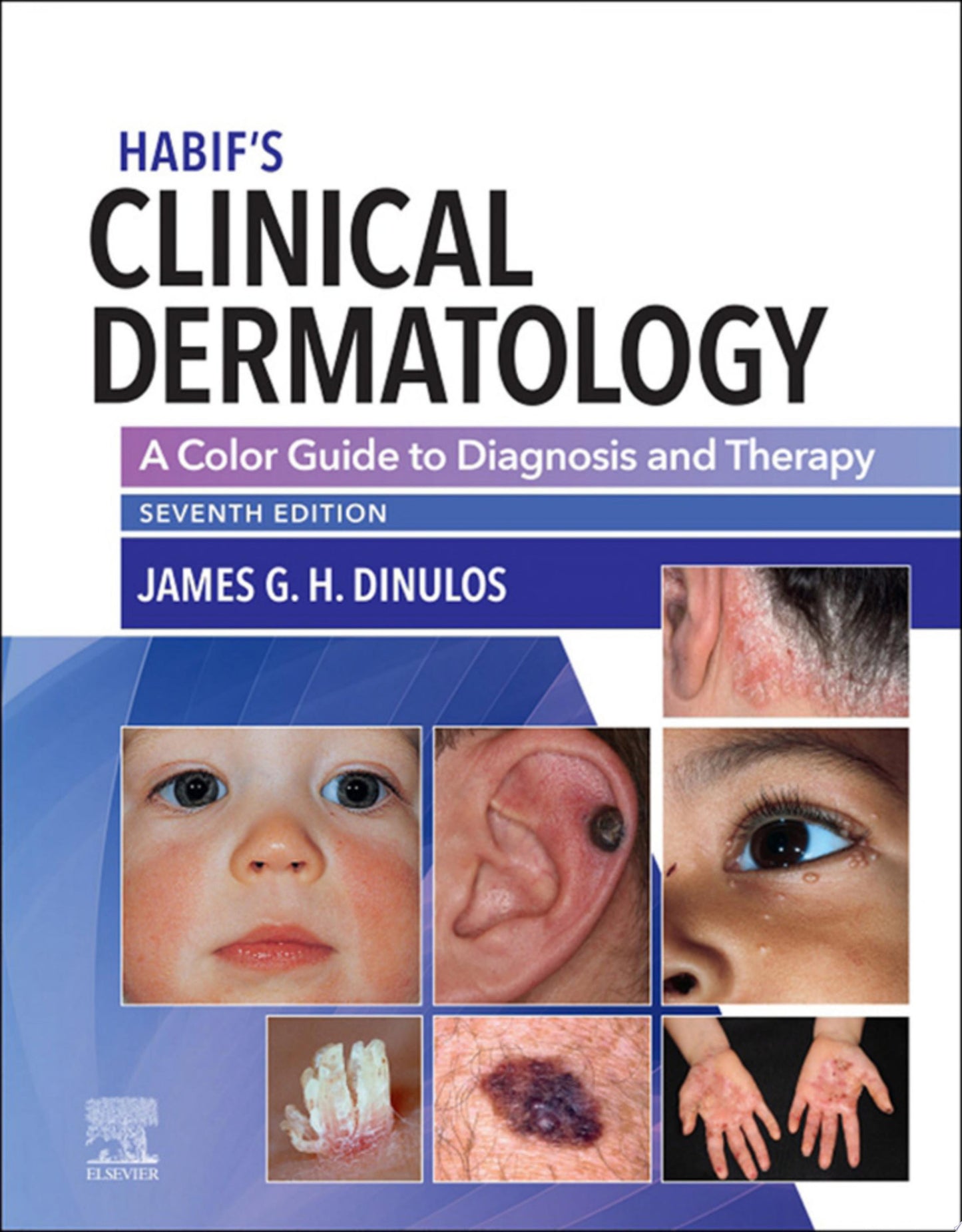 Habif’s Clinical Dermatology: A Color Guide to Diagnosis and Therapy, 7th edition