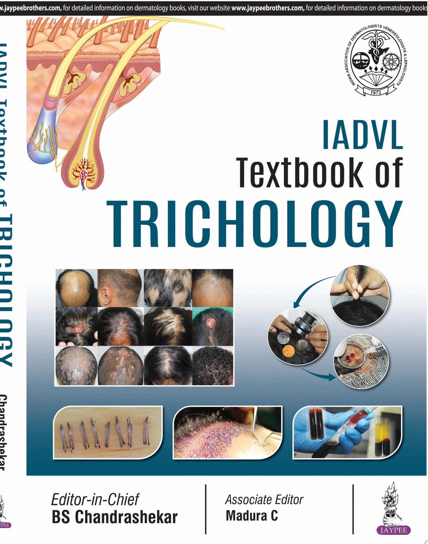IADVL Textbook of Trichology