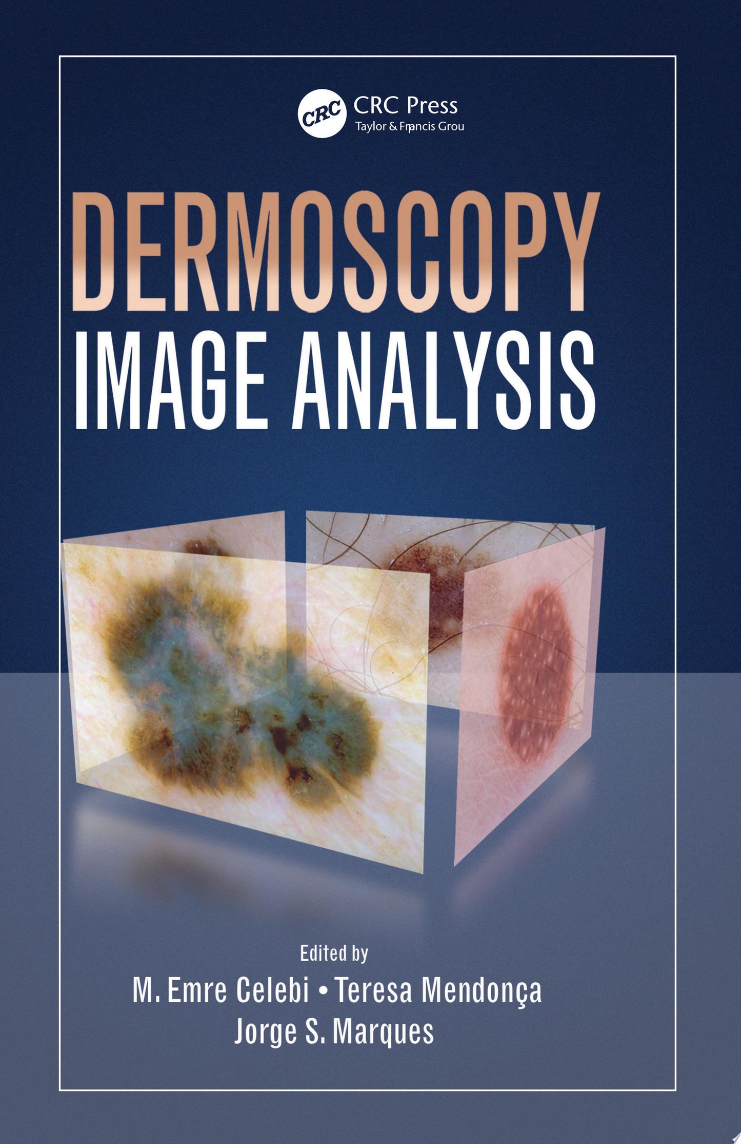 Dermoscopy Image Analysis