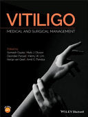 Vitiligo: Medical and Surgical Managmement