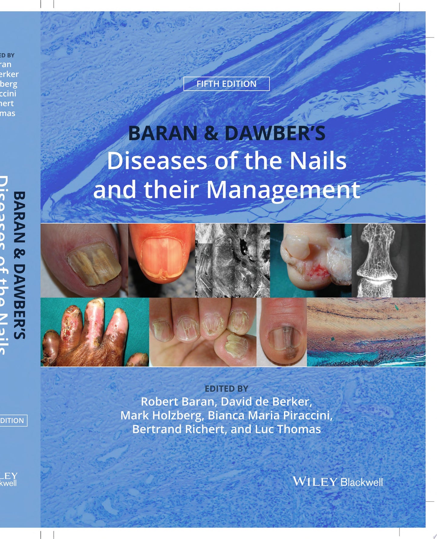 Baran and Dawber’s Diseases of the Nails and their Management, 5ed