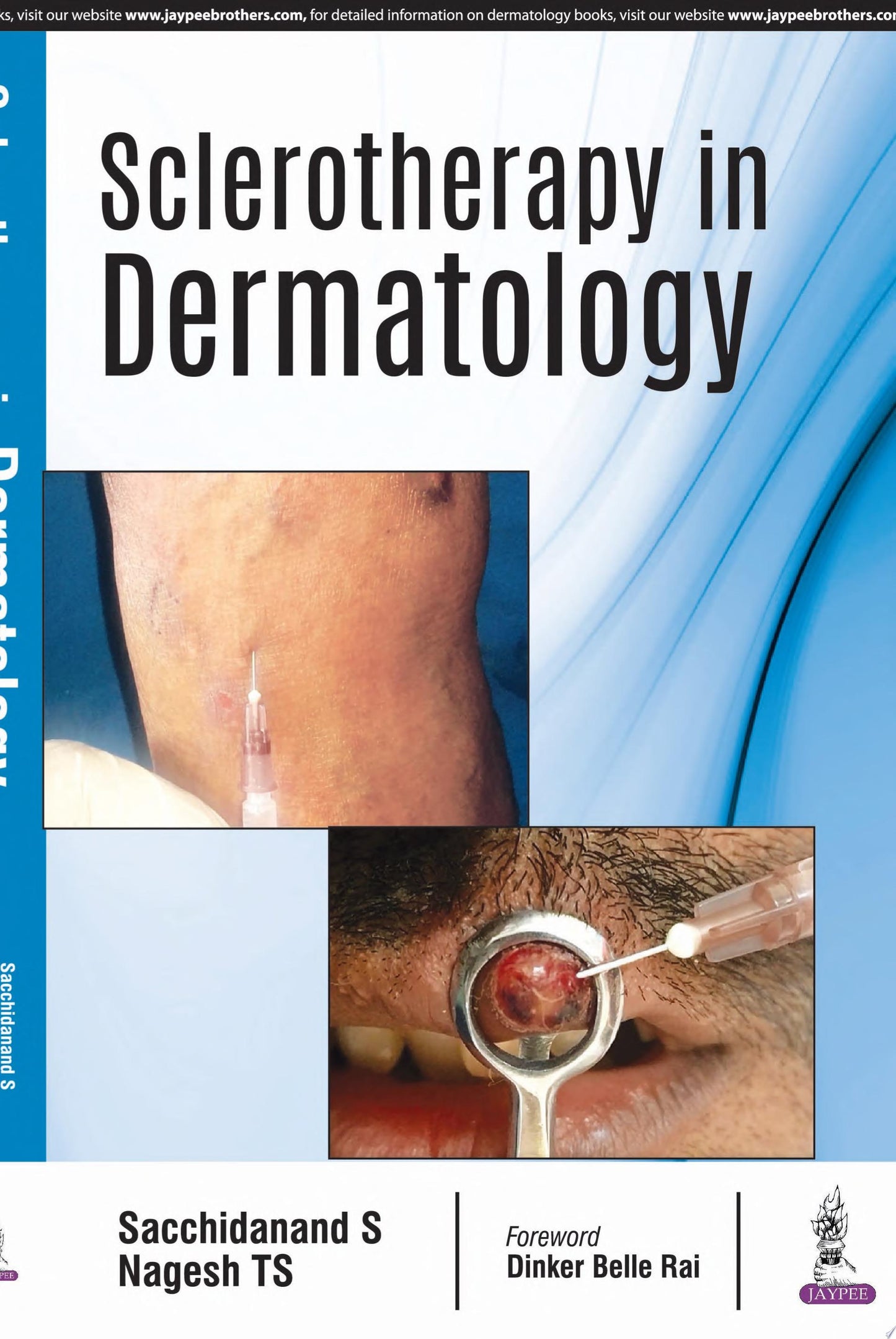 Sclerotherapy in Dermatology