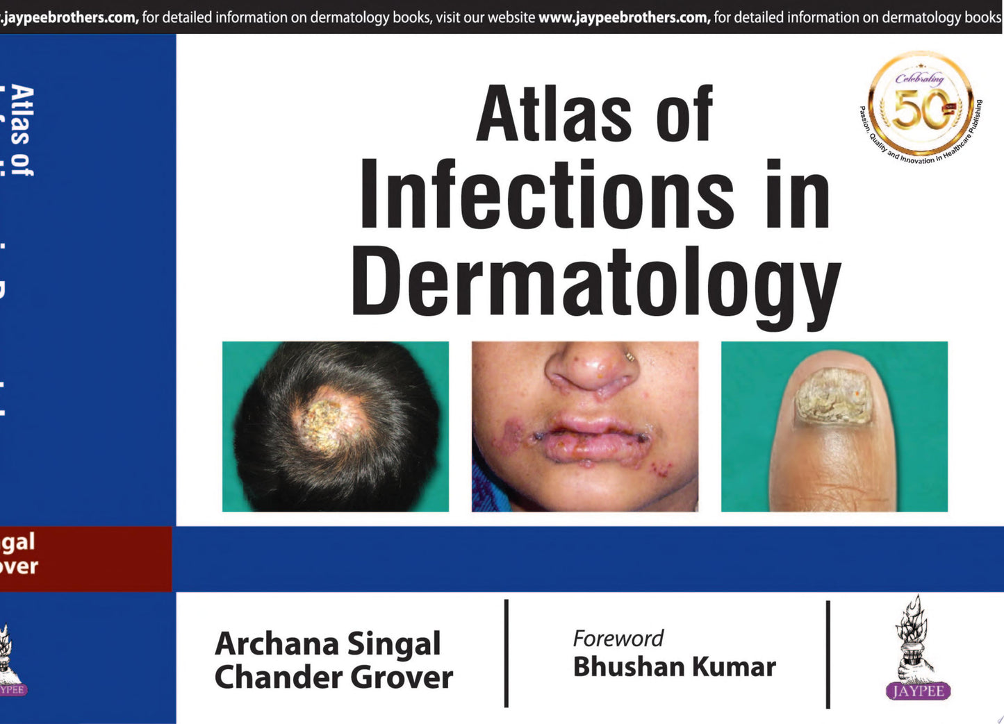 Atlas of Infections in Dermatology
