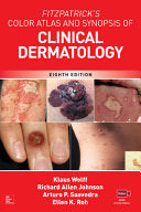 Fitzpatrick’s Color Atlas and Synopsis of Clinical Dermatology, Eighth Edition