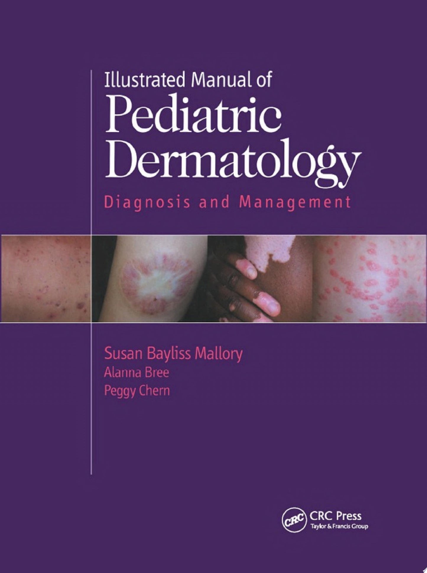 Illustrated Manual of Pediatric Dermatology: Diagnosis and Management