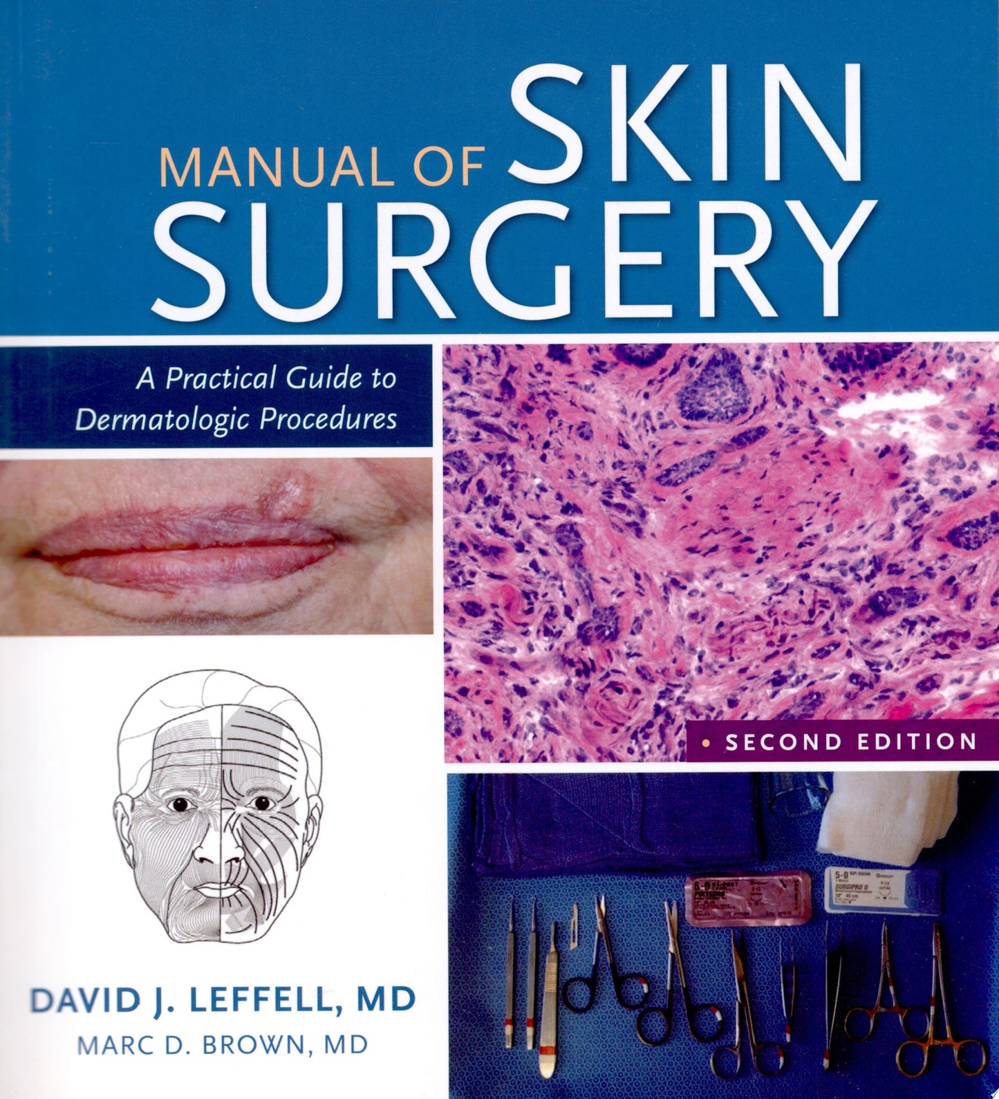 Manual of Skin Surgery: A Practical Guide to Dermatologic Procedures