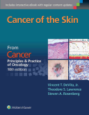 Cancer of the Skin: A Derivative of Cancer: Principles & Practice of Oncology, 10th Edition