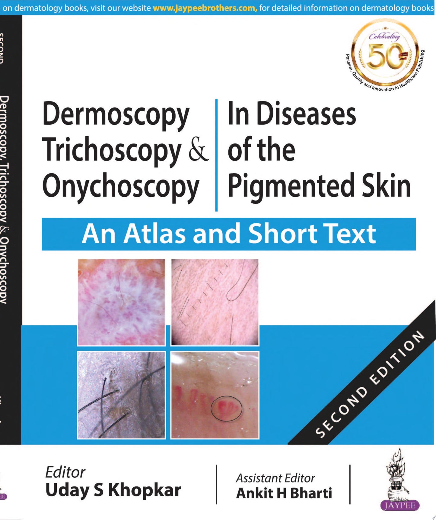 Dermoscopy, Trichoscopy & Onychoscopy In Diseases of the Pigmented Skin An Atlas and Short Text