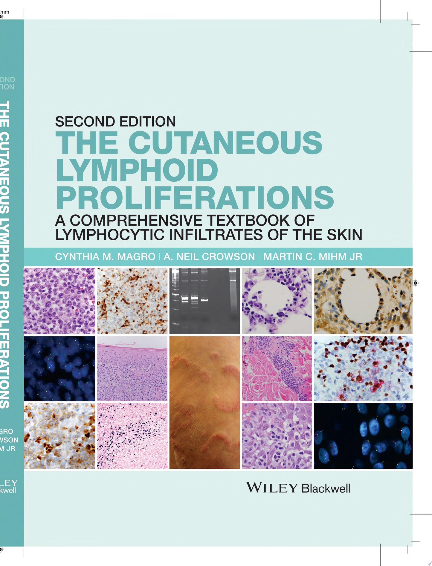 The Cutaneous Lymphoid Proliferations: A Comprehensive Textbook of Lymphocytic Infiltrates of the Skin, 2nd Edition