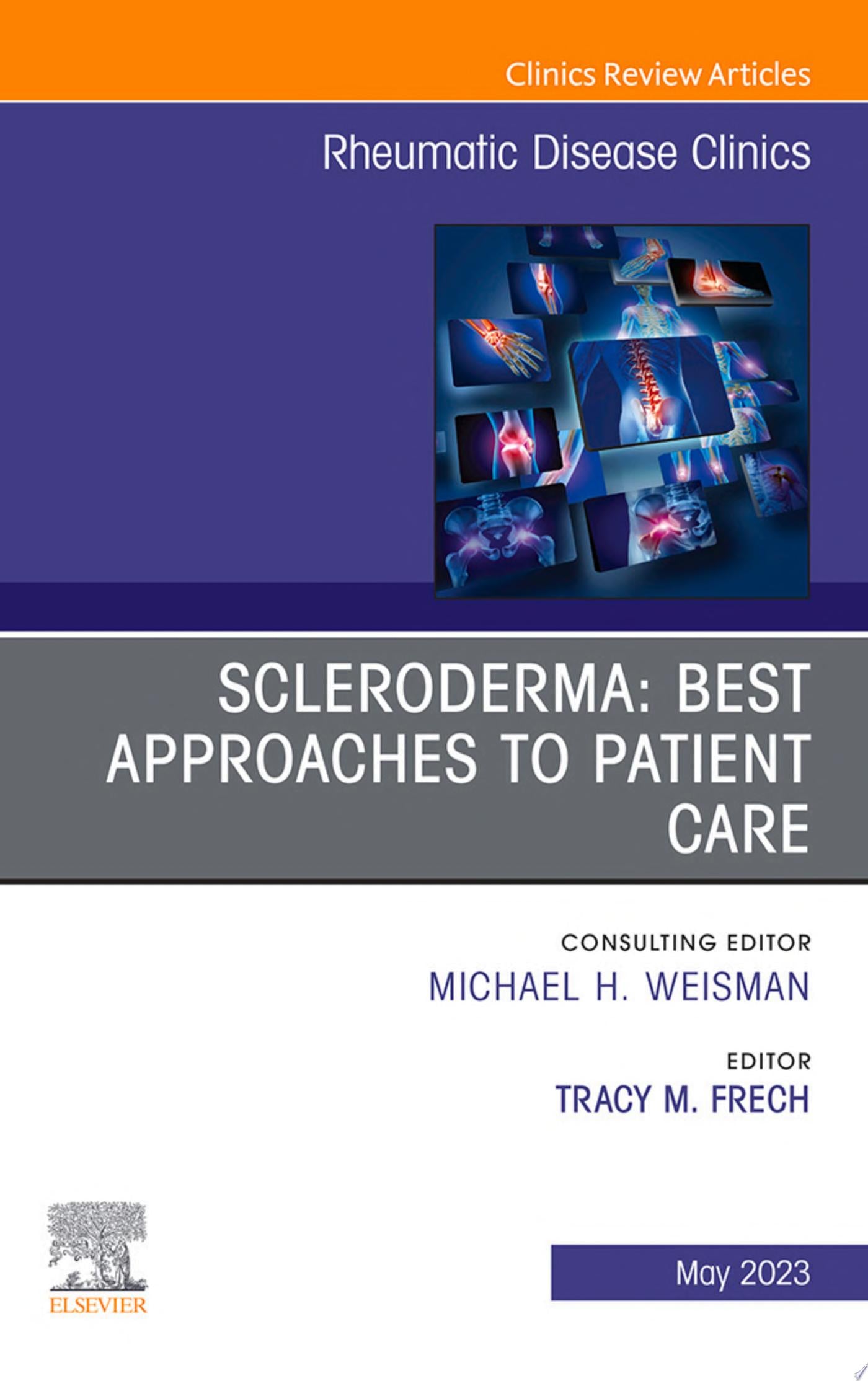 Scleroderma: Best Approaches to Patient Care, An Issue of Rheumatic Disease Clinics of North America