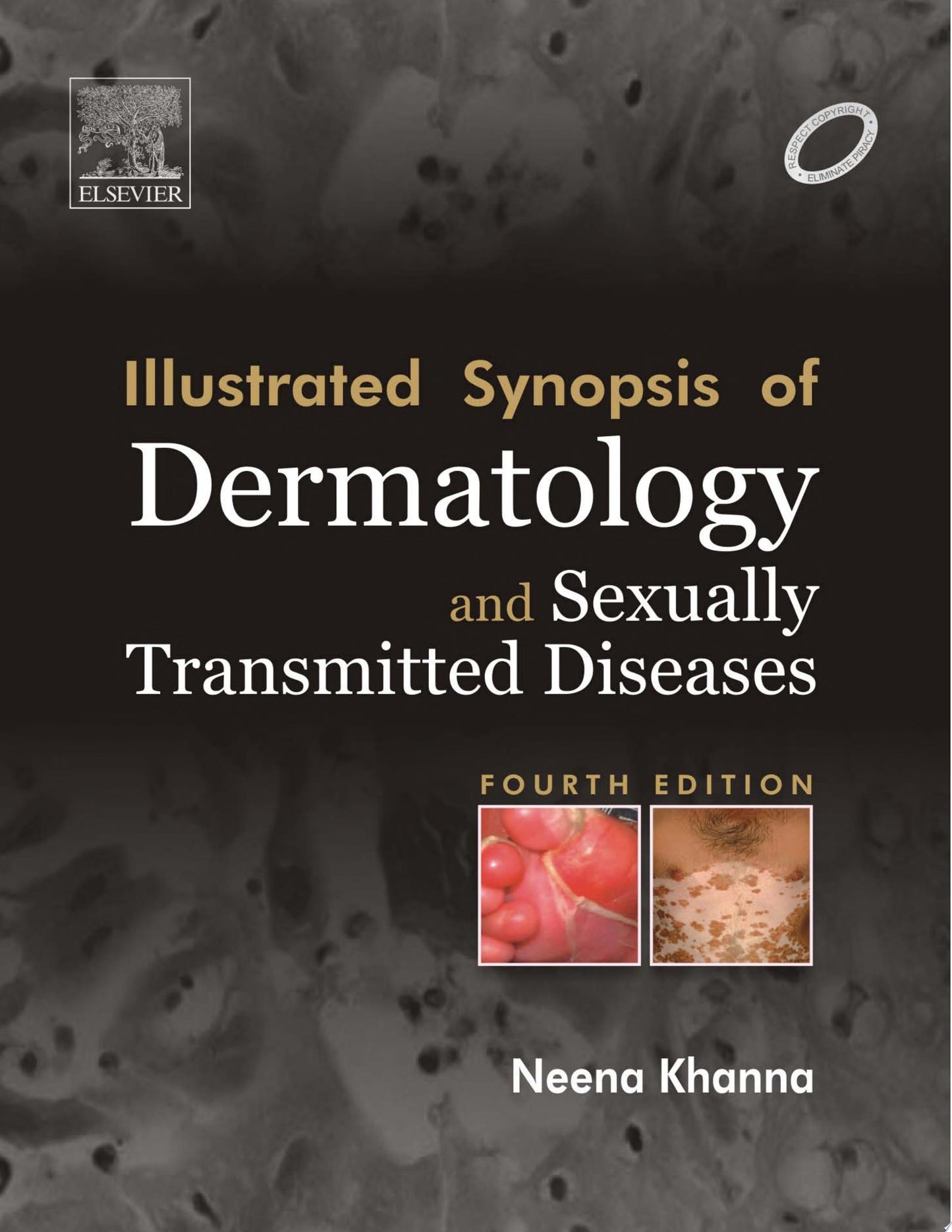 Illustrated Synopsis of Dermatology & Sexually Transmitted Diseases, Fourth Edition
