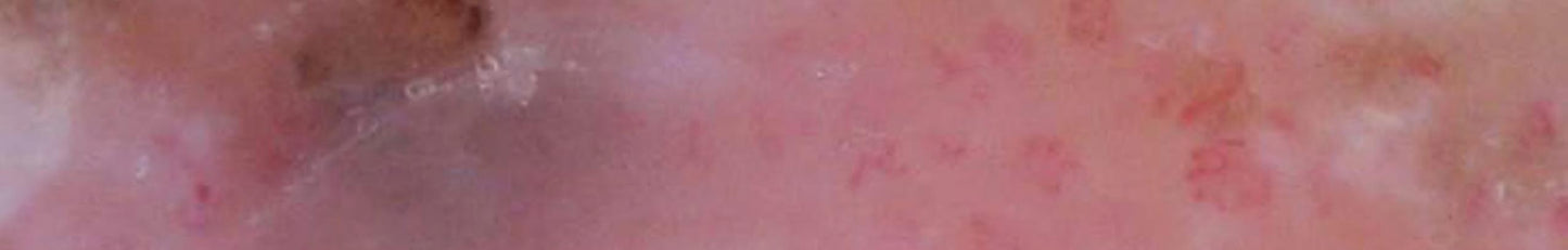 Dermoscopy: An Illustrated Self-Assessment Guide, 2nd Edition