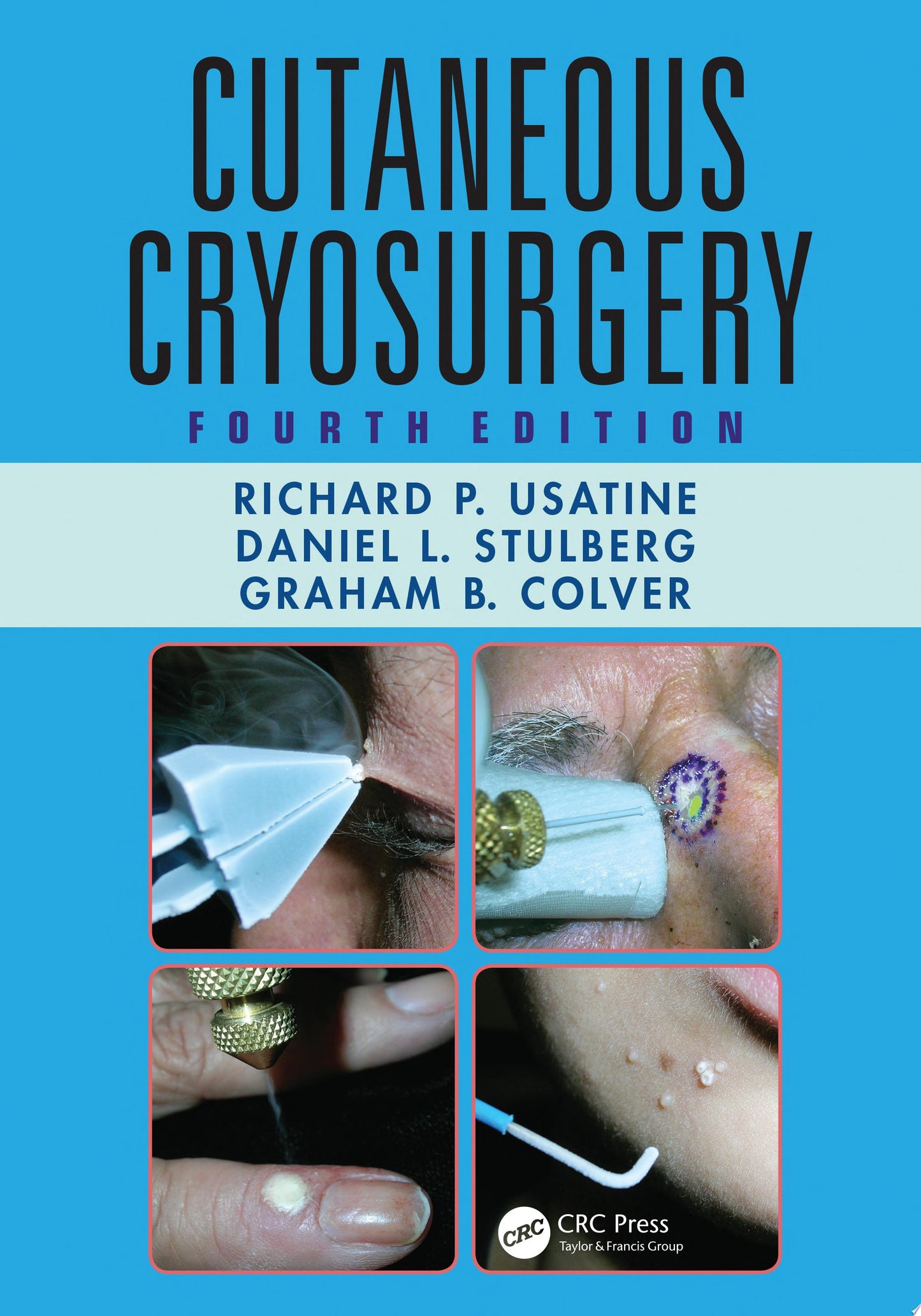 Cutaneous Cryosurgery, Fourth Edition