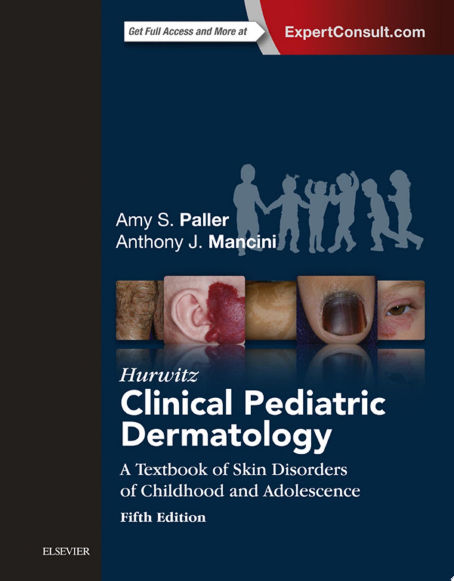Hurwitz Clinical Pediatric Dermatology, 5th Edition