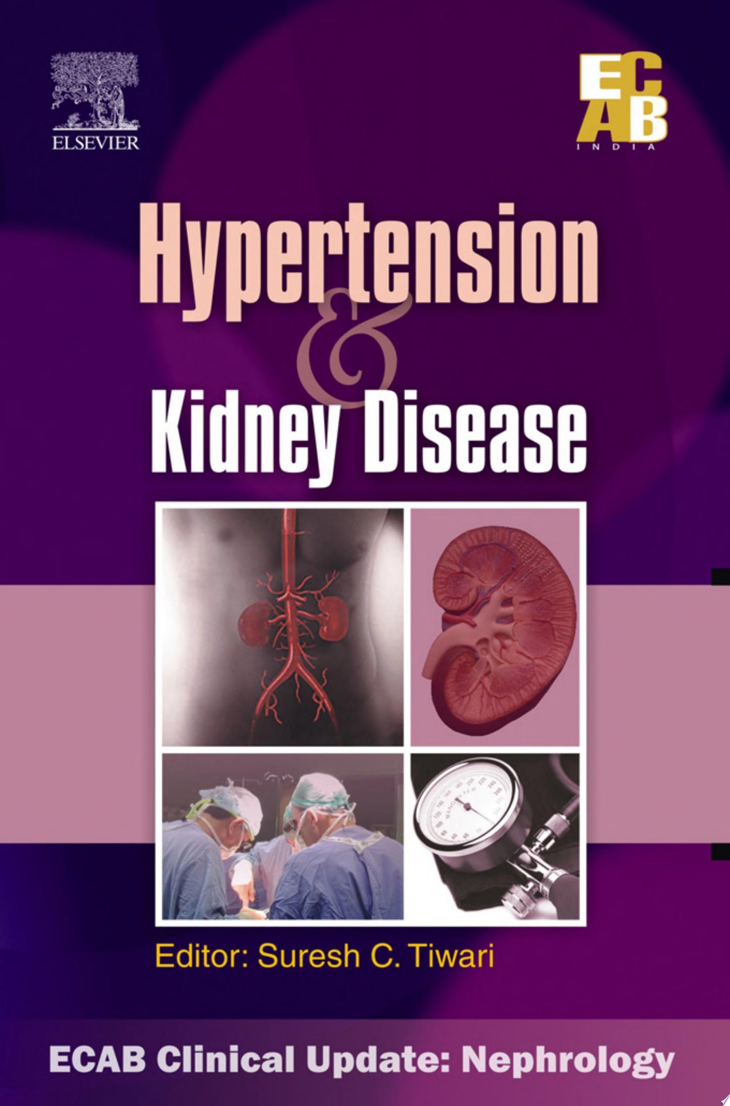 Hypertension and Kidney Disease – ECAB