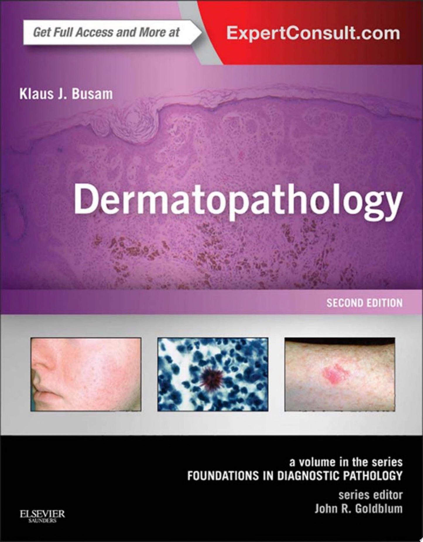 Dermatopathology: A Volume in the Series: Foundations in Diagnostic Pathology, 2nd Edition