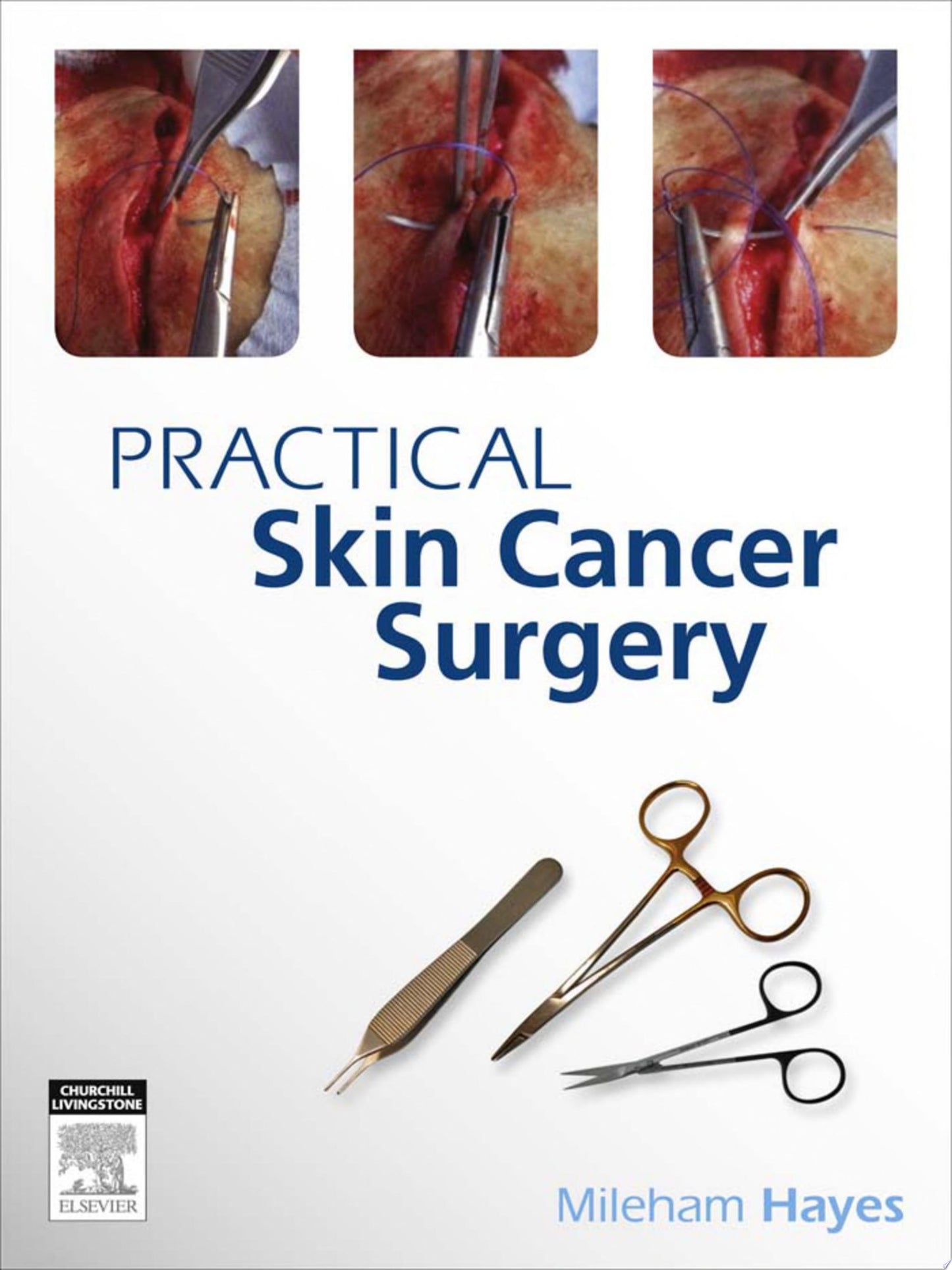 PRACTICAL SKIN CANCER SURGERY