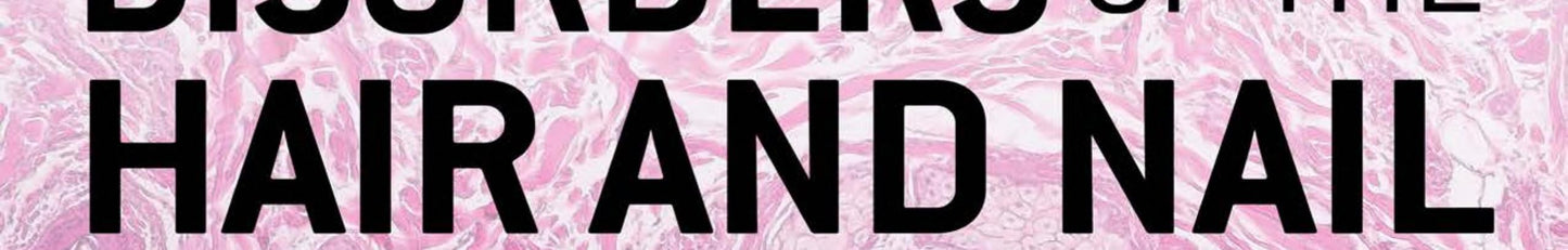 Disorders of the Hair and Nail: Diagnosis and Treatment