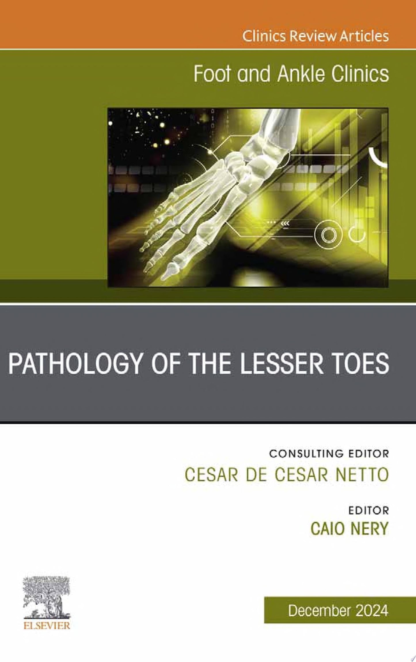 Pathology of the Lesser Toes, An issue of Foot and Ankle Clinics of North America