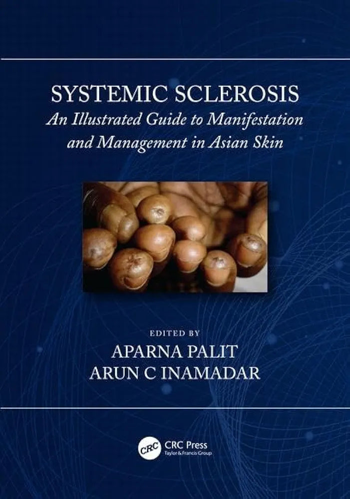 Systemic Sclerosis: An Illustrated Guide to Manifestation and Management in Asian Skin