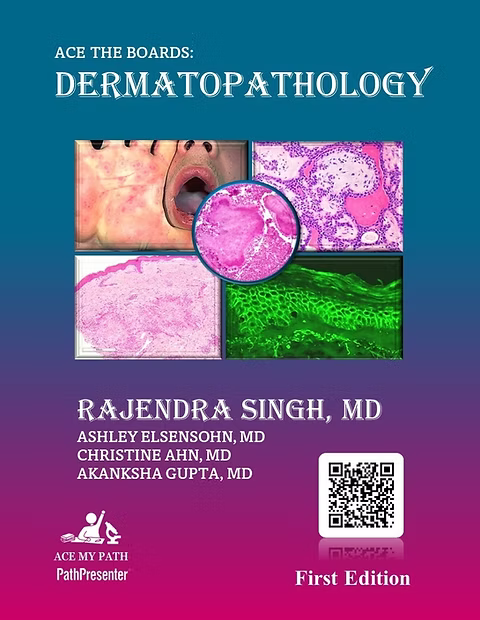 Ace The Boards: Dermatopathology