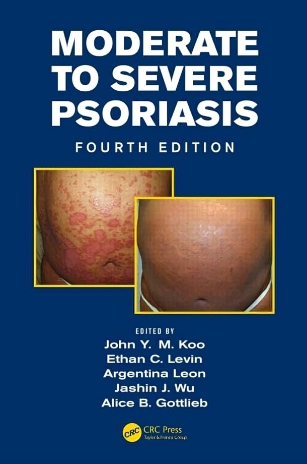 Moderate to Severe Psoriasis, Fourth Edition