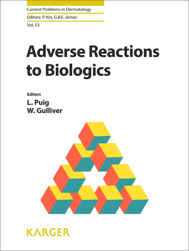 Adverse Reactions to Biologics