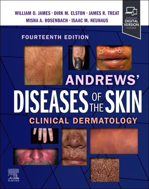 Andrews’ Diseases of the Skin: Clinical Dermatology, 14th Edition