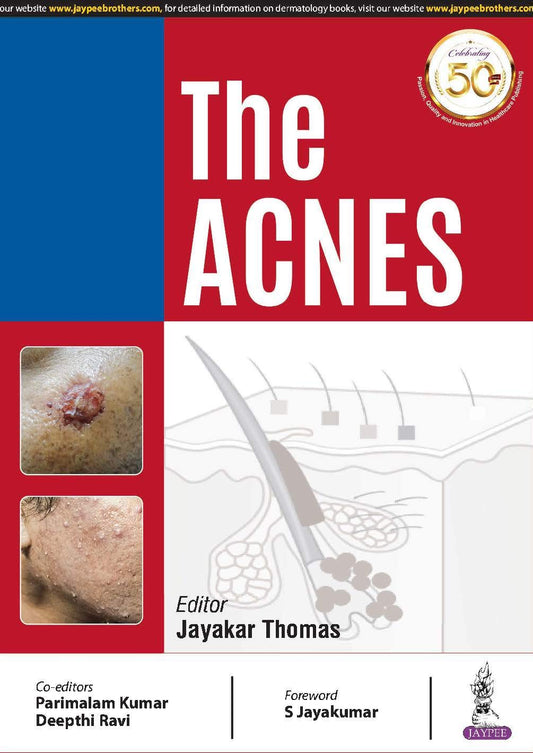 The Acnes
