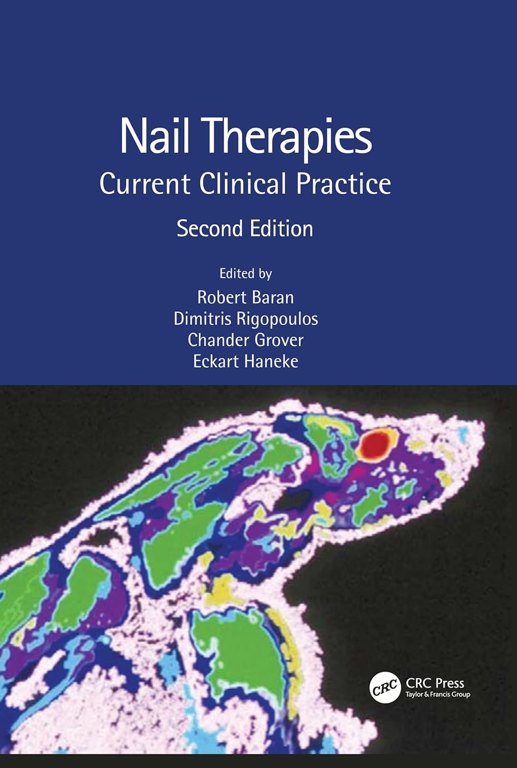 Nail Therapies: Current Clinical Practice, 2nd Edition