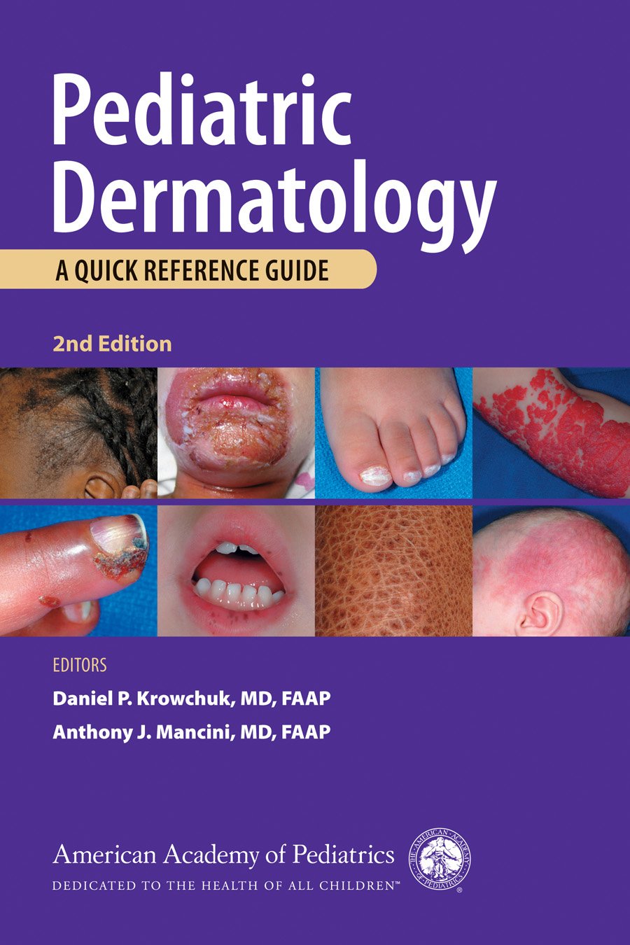 Pediatric Dermatology: A Quick Reference Guide, 2nd Edition