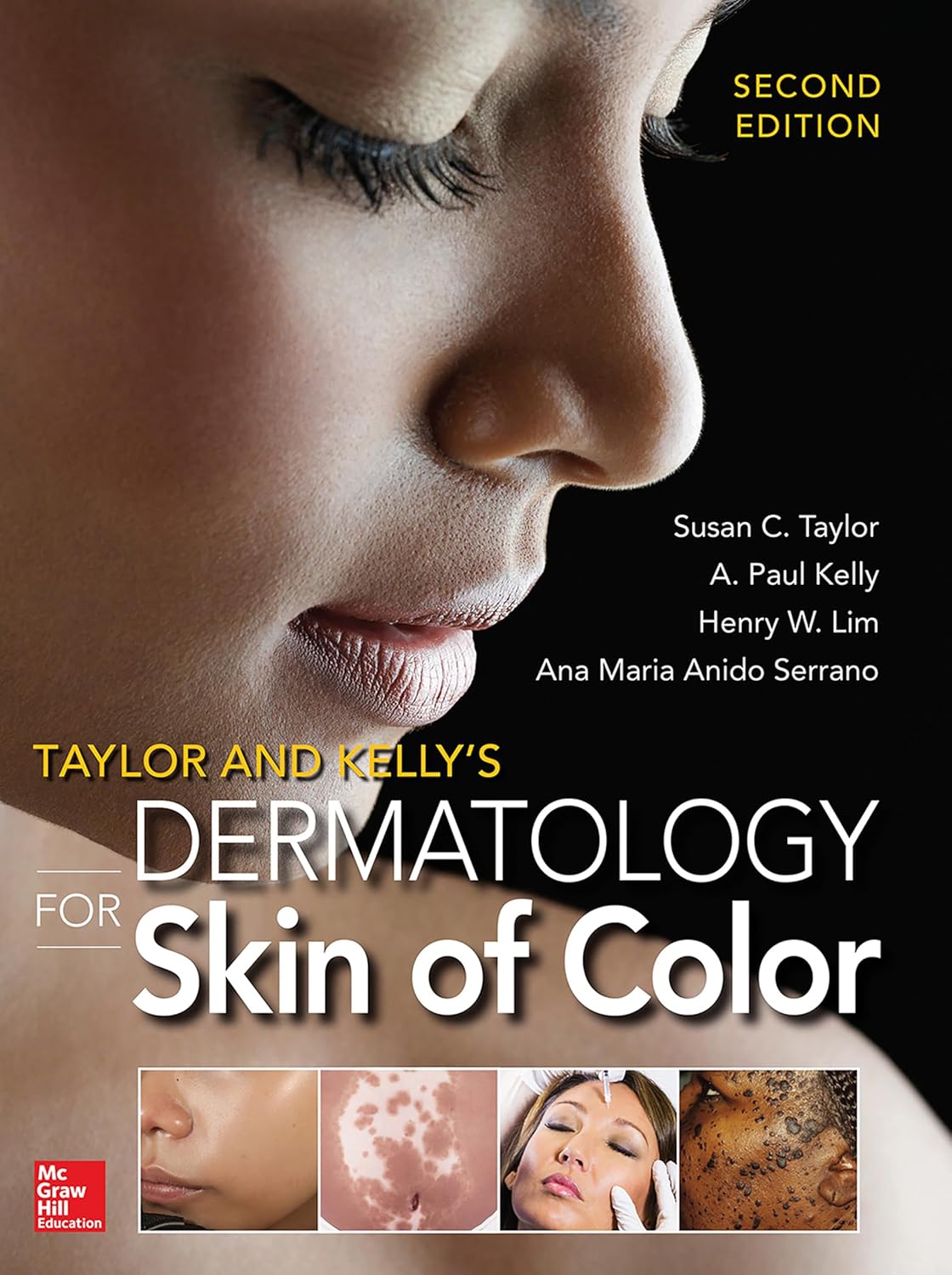 Taylor and Kelly’s Dermatology for Skin of Color, 2nd Edition