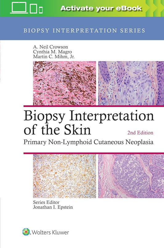 Biopsy Interpretation of the Skin: Primary Non-Lymphoid Cutaneous Neoplasia, 2nd Edition