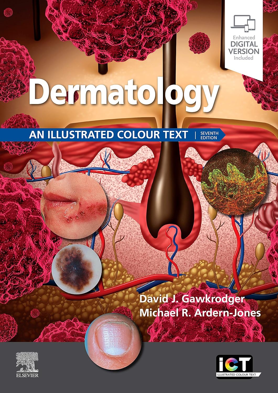 Dermatology: An Illustrated Colour Text, 7th Edition