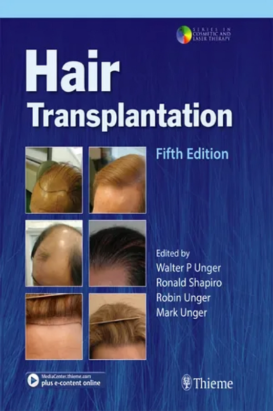 Hair Transplantation, 5ed