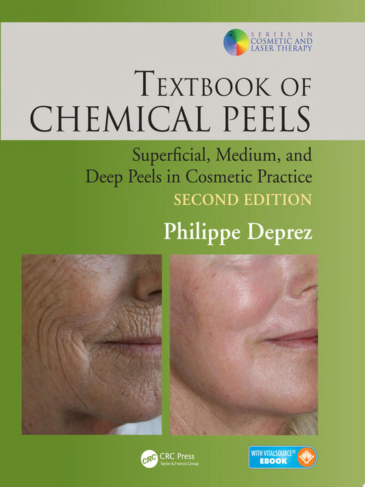 Chemical Peels in Clinical Practice