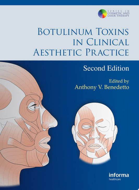 Botulinum Toxin Treatment: What Everyone Should Know, 2nd Edition