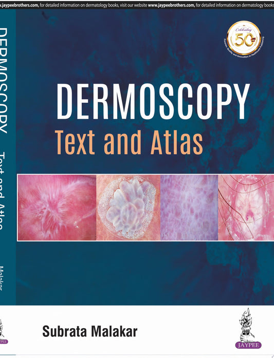 Dermoscopy: The Essentials, 2nd Edition