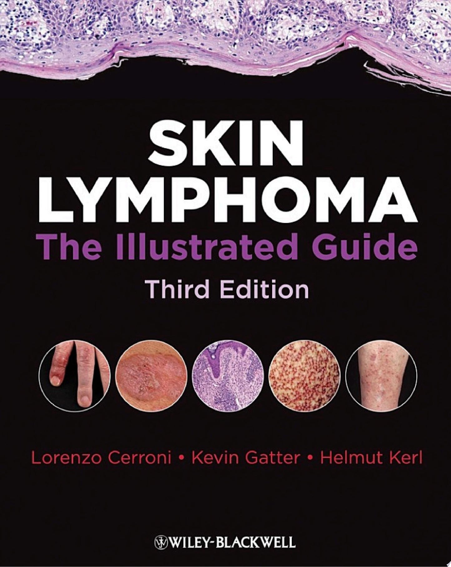 Skin Lymphoma: The Illustrated Guide, 5th Edition