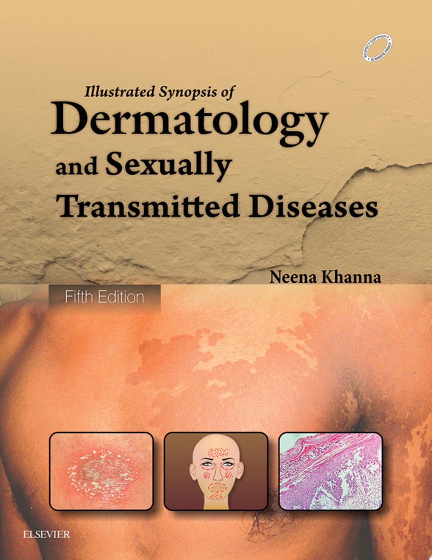 Illustrated Synopsis of Dermatology & Sexually Transmitted Diseases, 6th Edition