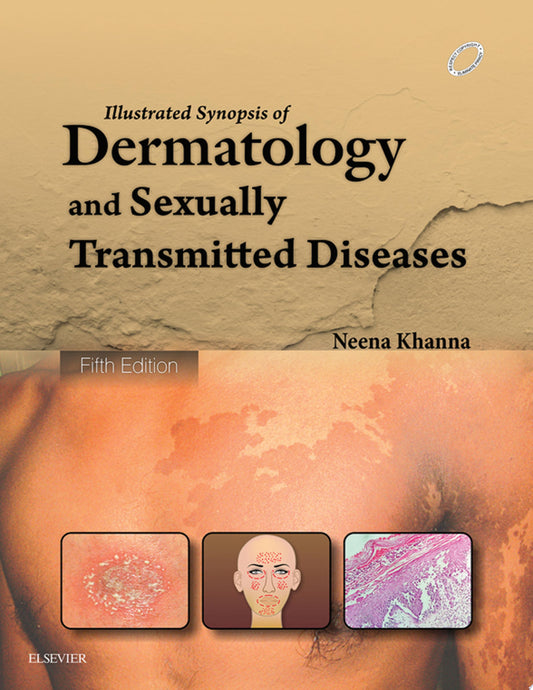 Illustrated Synopsis of Dermatology & Sexually Transmitted Diseases, 6th Edition